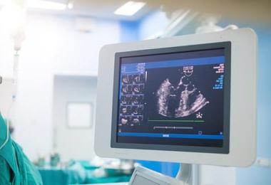 Echocardiogram in an operating room