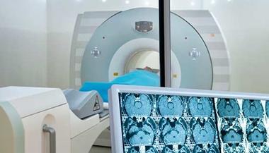 Brain scans showed on a computer monitor, with a radiosurgery device in the background
