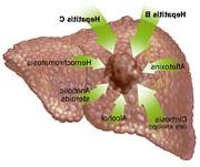 Causes of hepatocellular carcinoma